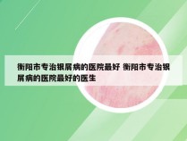 衡阳市专治银屑病的医院最好 衡阳市专治银屑病的医院最好的医生