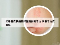 长春看皮肤病最好医院创新华山 长春华山皮肤科