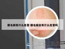 腋毛癣有什么危害 腋毛癣会有什么危害吗