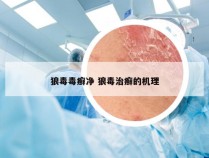 狼毒毒癣净 狼毒治癣的机理