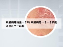 银屑病开始是一个吗 银屑病是一个一个的起还是几个一起起