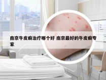 南京牛皮癣治疗哪个好 南京最好的牛皮癣专家