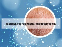 银屑病可以吃少量胡椒吗 银屑病能吃葫芦吗