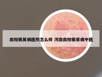 南阳银屑病医院怎么样 河南南阳银屑病中医