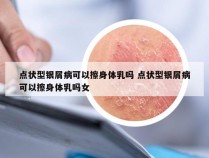点状型银屑病可以擦身体乳吗 点状型银屑病可以擦身体乳吗女