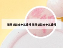 银屑病能吃十三香吗 银屑病能吃十三香吗