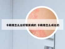 卡戴珊怎么冶好银屑病的 卡戴珊怎么成名的
