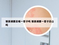 银屑病要忌嘴一辈子吗 银屑病要一辈子忌口吗