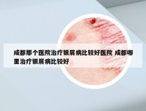 成都那个医院治疗银屑病比较好医院 成都哪里治疗银屑病比较好