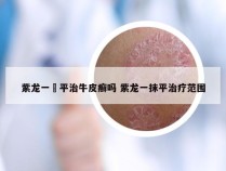紫龙一抺平治牛皮癣吗 紫龙一抹平治疗范围