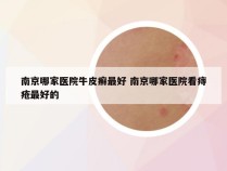 南京哪家医院牛皮癣最好 南京哪家医院看痔疮最好的