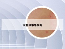 没有城市牛皮癣