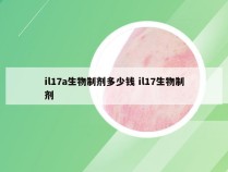il17a生物制剂多少钱 il17生物制剂
