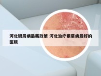 河北银屑病最新政策 河北治疗银屑病最好的医院