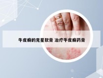 牛皮癣的克星软膏 冶疗牛皮癣药膏