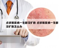 点状银屑病一生都没扩散 点状银屑病一生都没扩散怎么办