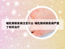 哺乳期银屑病注意什么 哺乳期间银屑病严重了如何治疗
