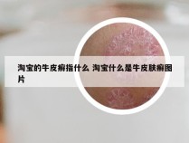 淘宝的牛皮癣指什么 淘宝什么是牛皮肤癣图片