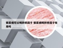 银屑病可以喝转移因子 银屑病喝转移因子有用吗