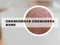 抗银屑病的蔬菜和水果 抗银屑病的蔬菜和水果有哪些