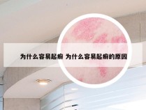 为什么容易起癣 为什么容易起癣的原因