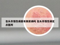 包头市慢性病里有银屑病吗 包头市慢性病定点医院