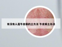 有没有人是牛皮癣的土方法 牛皮癣土办法