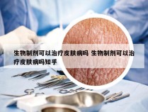 生物制剂可以治疗皮肤病吗 生物制剂可以治疗皮肤病吗知乎