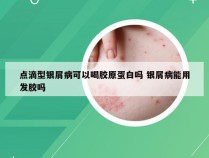 点滴型银屑病可以喝胶原蛋白吗 银屑病能用发胶吗