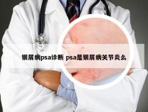 银屑病psa诊断 psa是银屑病关节炎么