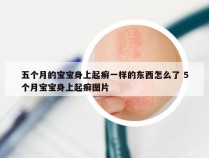 五个月的宝宝身上起癣一样的东西怎么了 5个月宝宝身上起癣图片