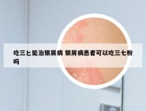 吃三匕能治银屑病 银屑病患者可以吃三七粉吗