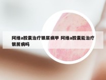 阿维a胶囊治疗银屑病甲 阿维a胶囊能治疗银屑病吗