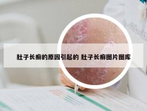 肚子长癣的原因引起的 肚子长癣图片图库