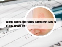 看银屑病在温州地区哪家医院最好的医院 温州看皮肤病哪里好