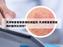 天津哪里看银屑病权威医院 天津哪里看银屑病的医院比较好?