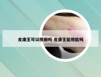 皮康王可以擦癣吗 皮康王能擦脸吗