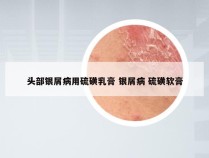 头部银屑病用硫磺乳膏 银屑病 硫磺软膏