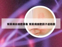 银屑病白细胞募集 银屑病细胞因子通路图