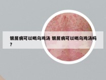 银屑病可以喝乌鸡汤 银屑病可以喝乌鸡汤吗?