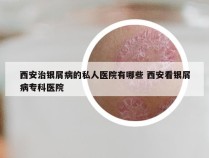 西安治银屑病的私人医院有哪些 西安看银屑病专科医院