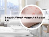 中国医科大学银屑病 中国医科大学皮肤病研究所