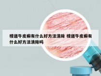 楼道牛皮癣有什么好方法清除 楼道牛皮癣有什么好方法清除吗