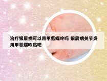 治疗银屑病可以用甲氨蝶呤吗 银屑病关节炎用甲氨蝶呤贴吧