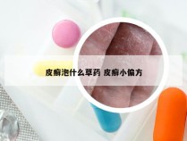 皮癣泡什么草药 皮癣小偏方