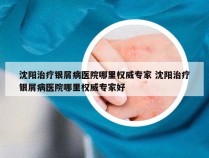 沈阳治疗银屑病医院哪里权威专家 沈阳治疗银屑病医院哪里权威专家好