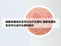 硝酸咪康唑乳膏可以治疗头癣吗 硝酸咪康唑乳膏可以治疗头癣吗图片