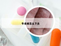 牛皮癣怎么下去
