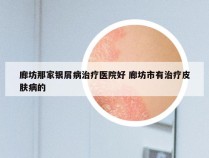 廊坊那家银屑病治疗医院好 廊坊市有治疗皮肤病的