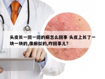 头皮长一团一团的癣怎么回事 头皮上长了一块一块的,像癣似的,咋回事儿?